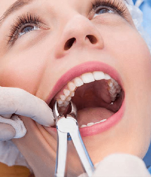 Dental Instruments